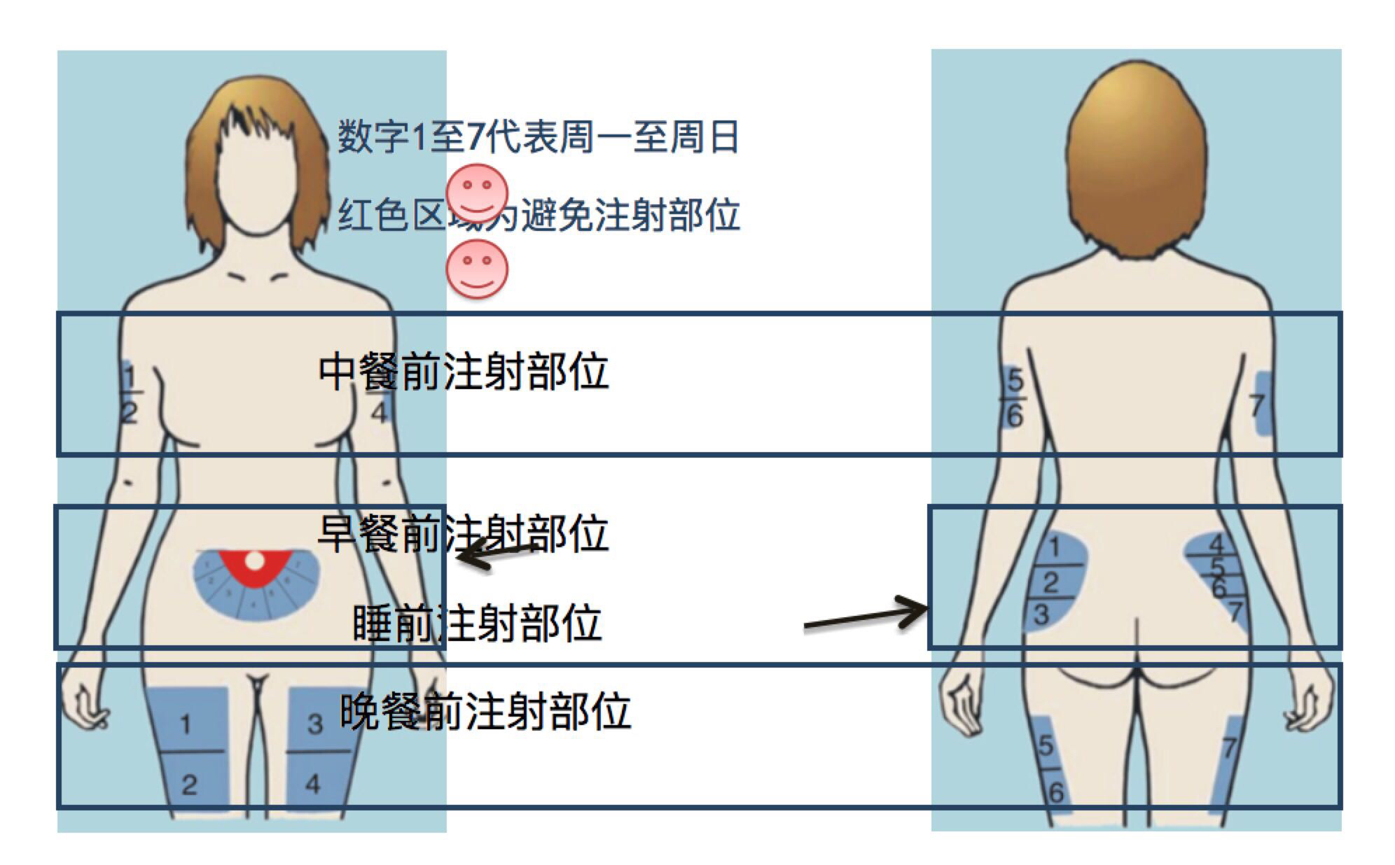 【独家·见微】同济"四部七区顺时针"注射法让糖友轻松控血糖